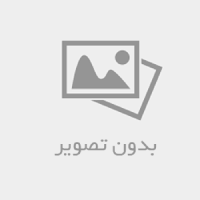 مراحل کامپوزیت دندان جلو